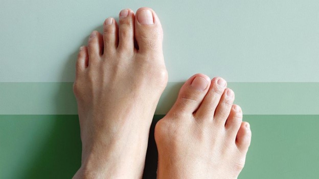 Multidisciplinary Approach to Foot Care